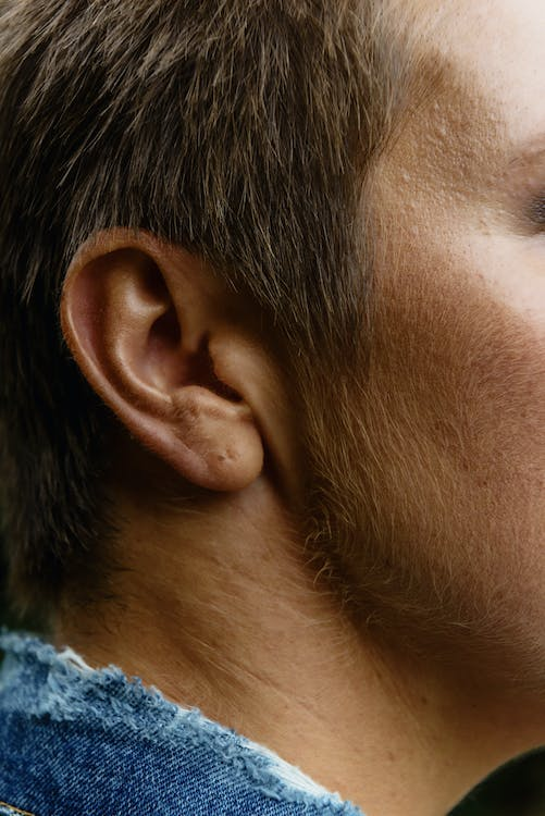 tinnitus